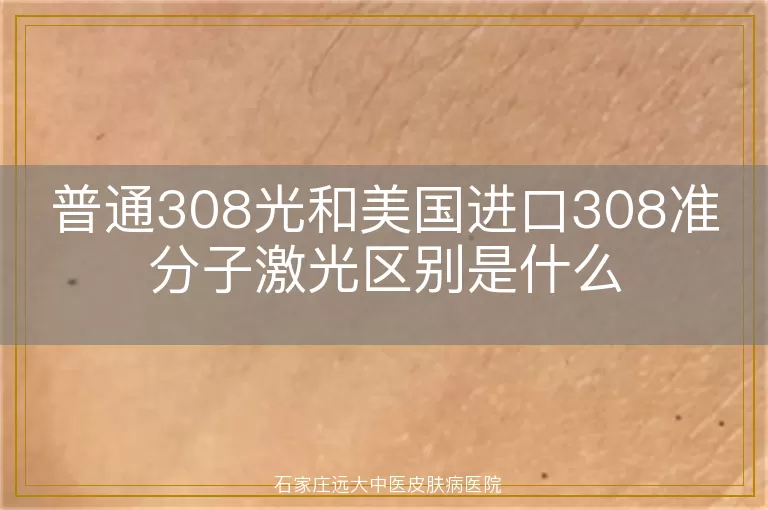 普通308光和美国进口308准分子激光区别是什么