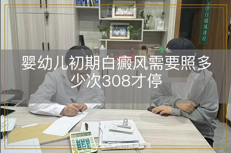 婴幼儿初期白癜风需要照多少次308才停