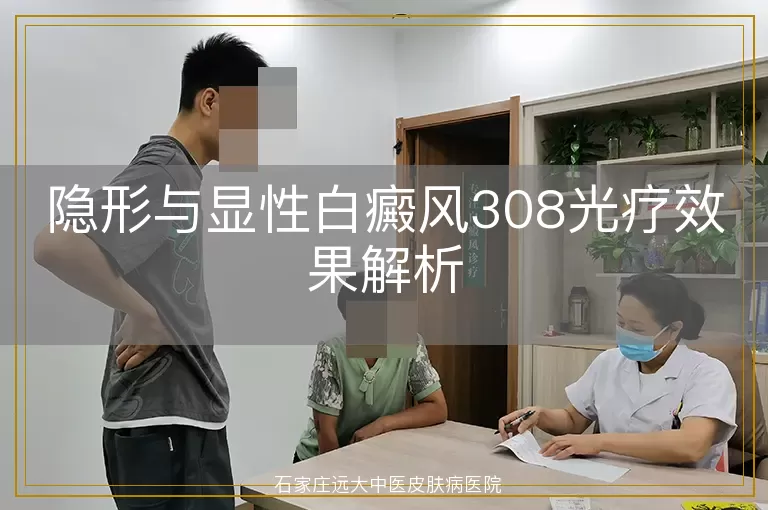 隐形与显性白癜风308光疗效果解析
