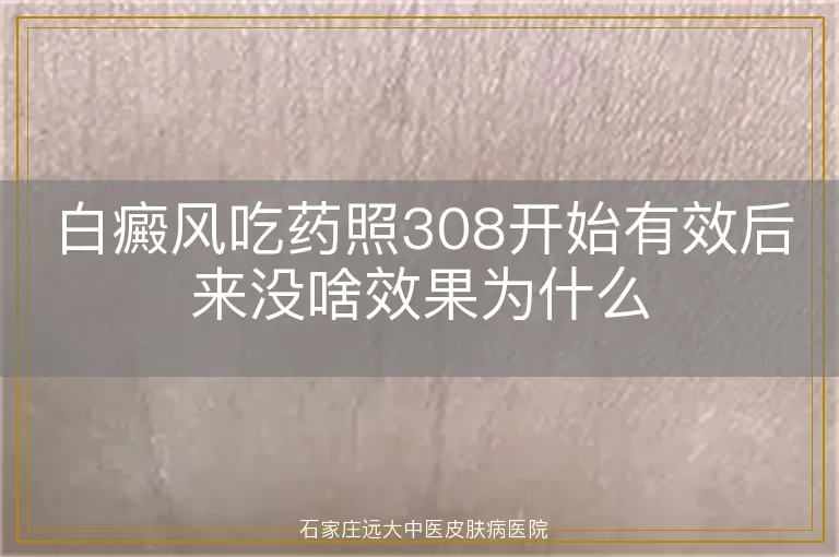 白癜风吃药照308开始有效后来没啥效果为什么