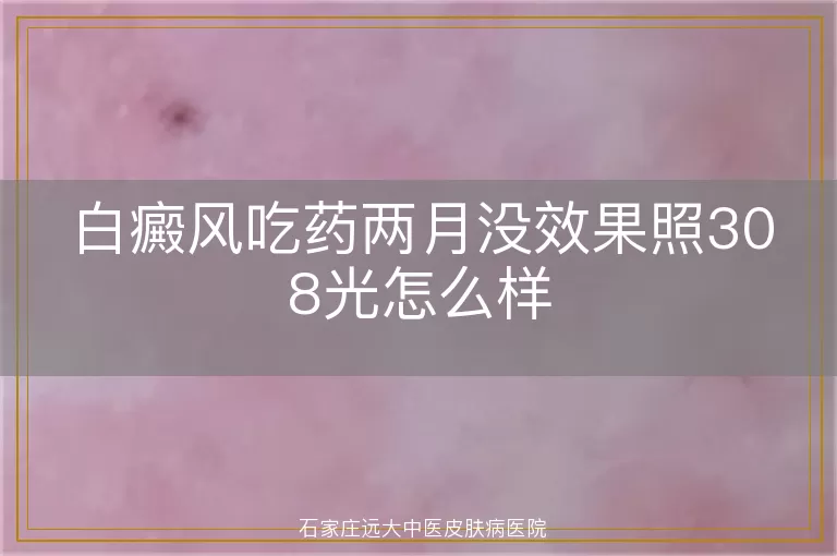 白癜风吃药两月没效果照308光怎么样