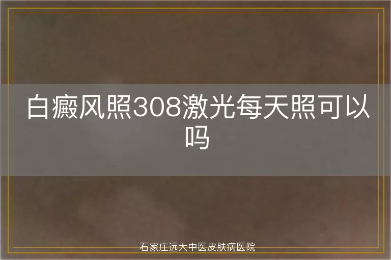 白癜风照308激光每天照可以吗