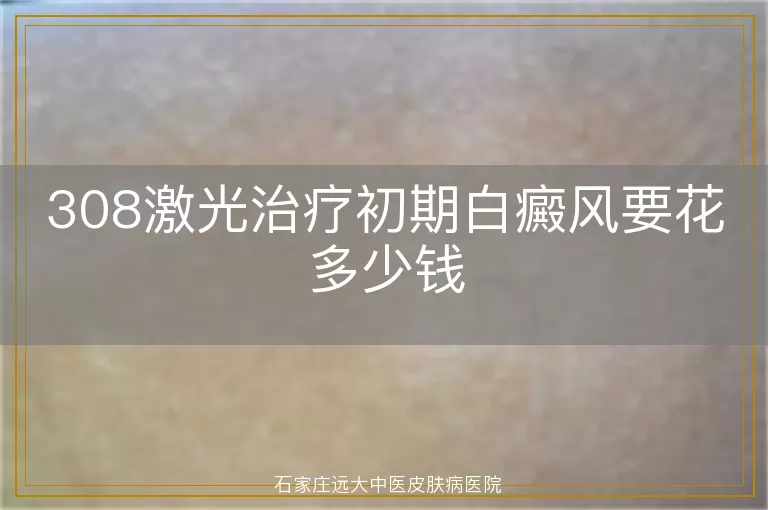 308激光治疗初期白癜风要花多少钱