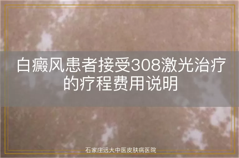 白癜风患者接受308激光治疗的疗程费用说明