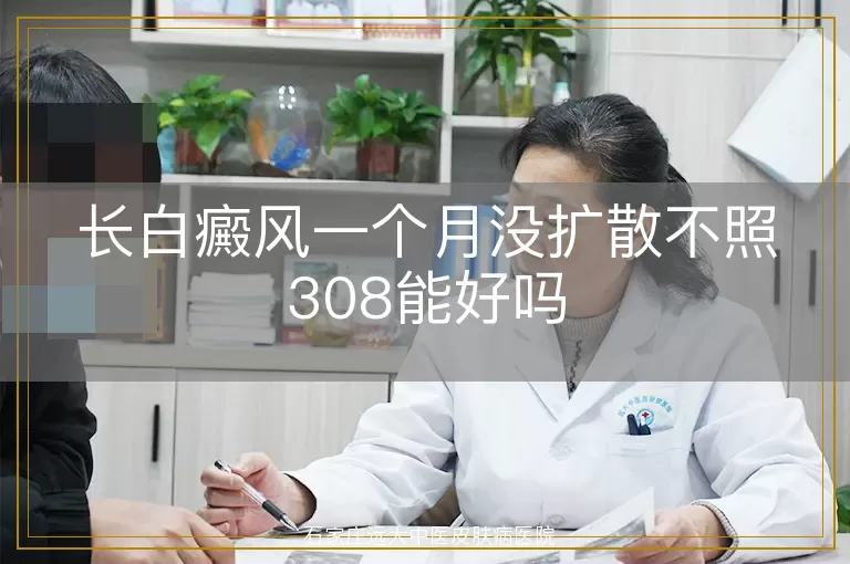 长白癜风一个月没扩散不照308能好吗