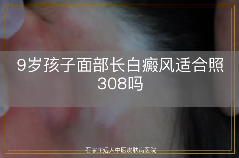 9岁孩子面部长白癜风适合照308吗