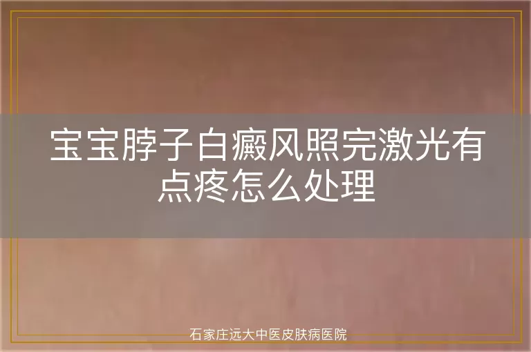 宝宝脖子白癜风照完激光有点疼怎么处理