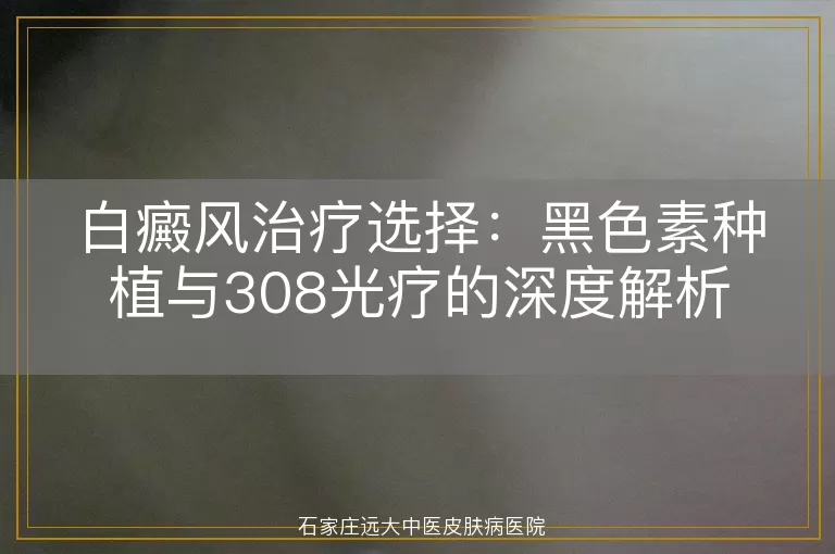 白癜风治疗选择：黑色素种植与308光疗的深度解析