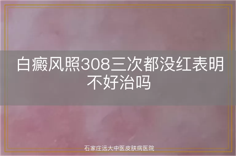 白癜风照308三次都没红表明不好治吗