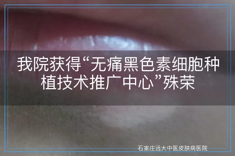 我院获得“无痛黑色素细胞种植技术推广中心”殊荣