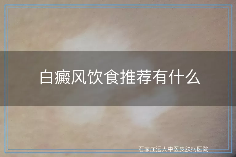 白癜风饮食推荐有什么