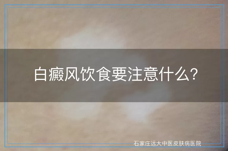 白癜风饮食要注意什么？