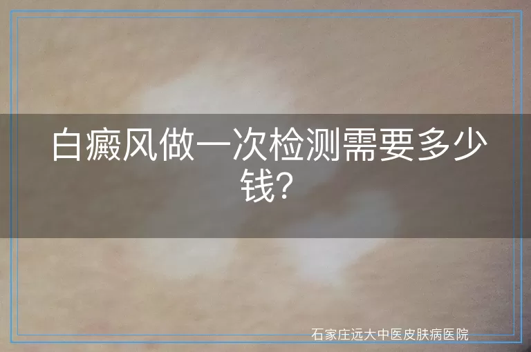 白癜风做一次检测需要多少钱？