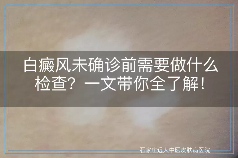 白癜风未确诊前需要做什么检查？一文带你全了解！