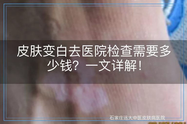 皮肤变白去医院检查需要多少钱？一文详解！