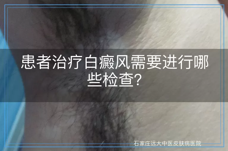 患者治疗白癜风需要进行哪些检查？