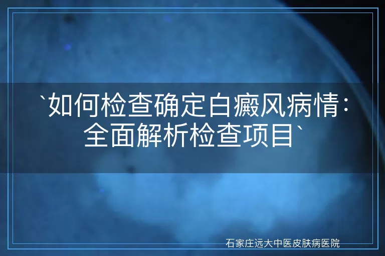 如何检查确定白癜风病情：全面解析检查项目