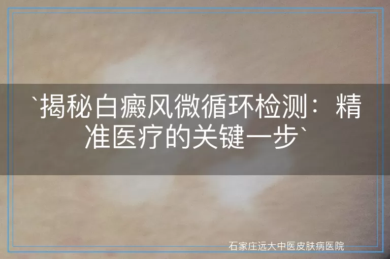 揭秘白癜风微循环检测：精准医疗的关键一步