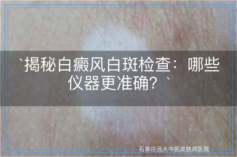 揭秘白癜风白斑检查：哪些仪器更准确？
