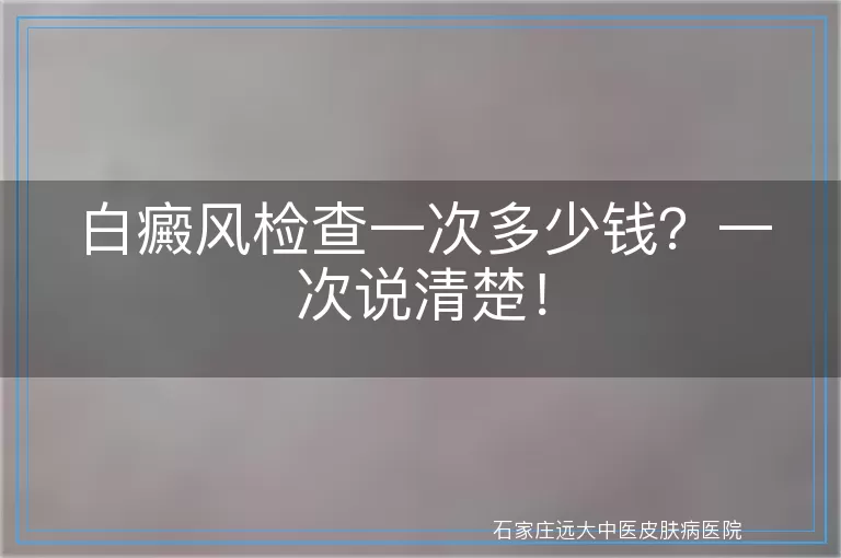 白癜风检查一次多少钱？一次说清楚！