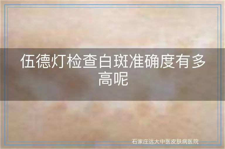 伍德灯检查白斑准确度有多高呢