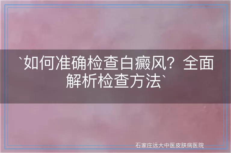 如何准确检查白癜风？全面解析检查方法