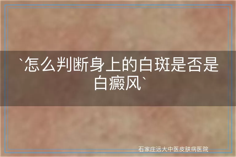 怎么判断身上的白斑是否是白癜风