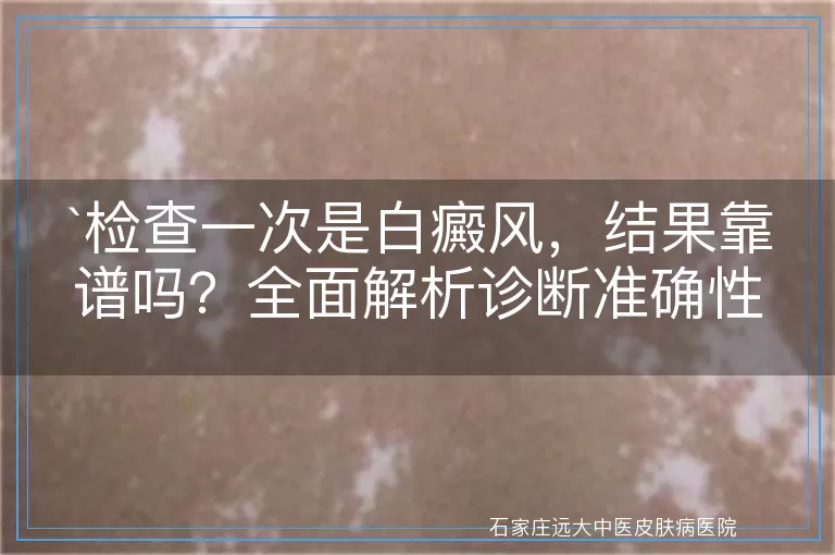 检查一次是白癜风，结果靠谱吗？全面解析诊断准确性