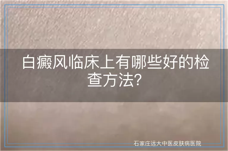白癜风临床上有哪些好的检查方法？