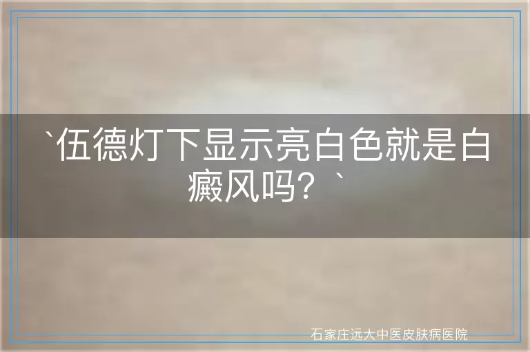 伍德灯下显示亮白色就是白癜风吗？