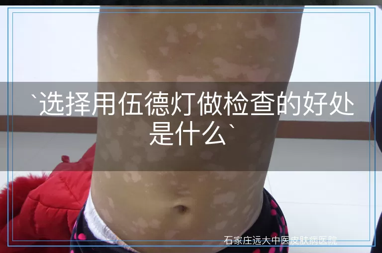 选择用伍德灯做检查的好处是什么