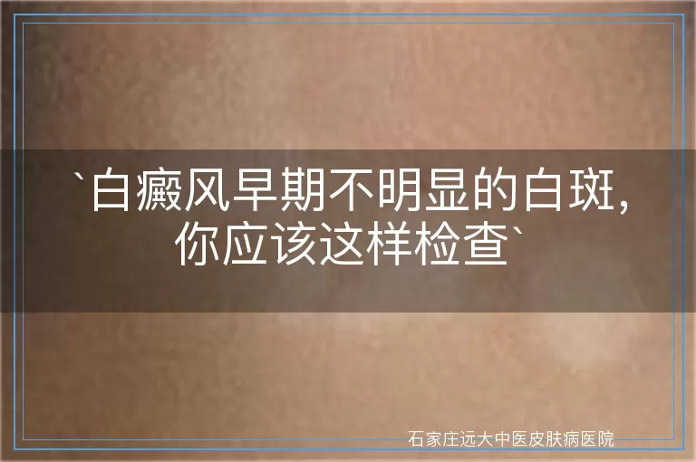 白癜风早期不明显的白斑，你应该这样检查