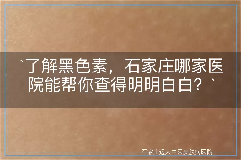 了解黑色素，石家庄哪家医院能帮你查得明明白白？