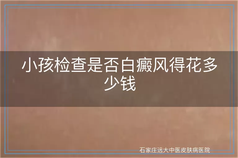 小孩检查是否白癜风得花多少钱