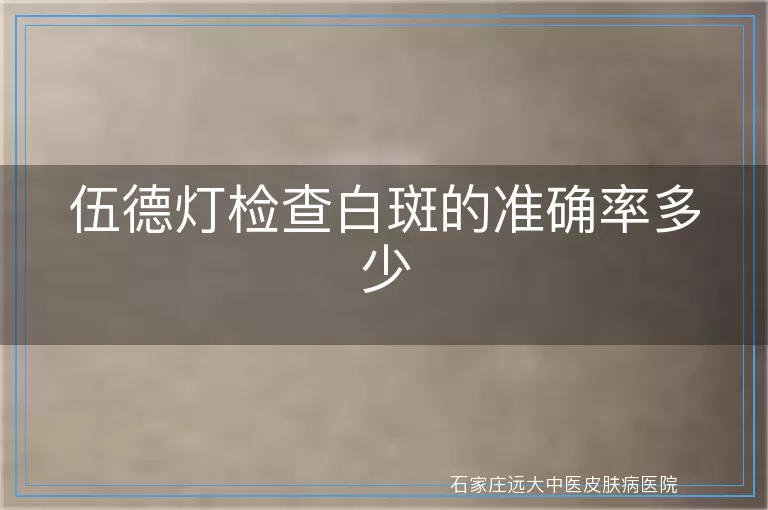 伍德灯检查白斑的准确率多少