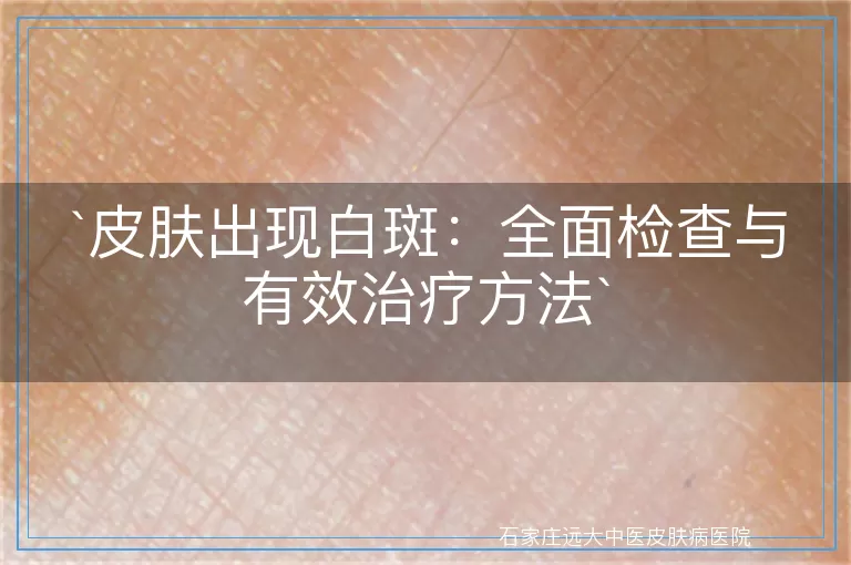 皮肤出现白斑：全面检查与有效治疗方法