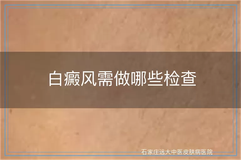 白癜风需做哪些检查