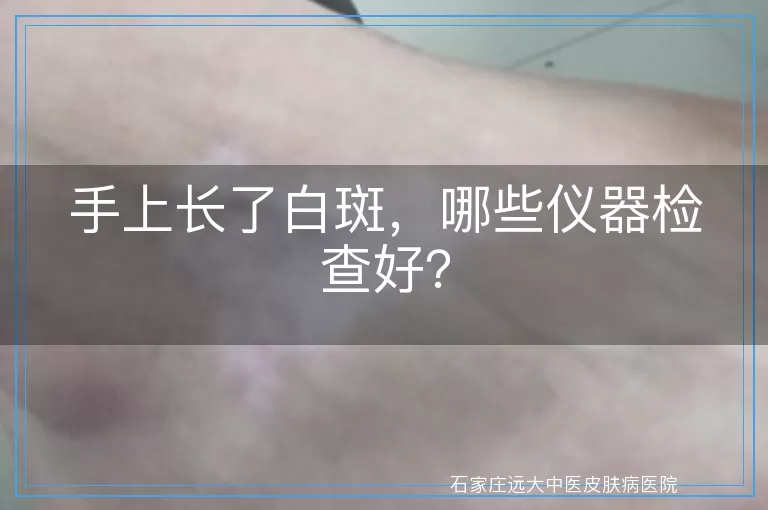 手上长了白斑，哪些仪器检查好？