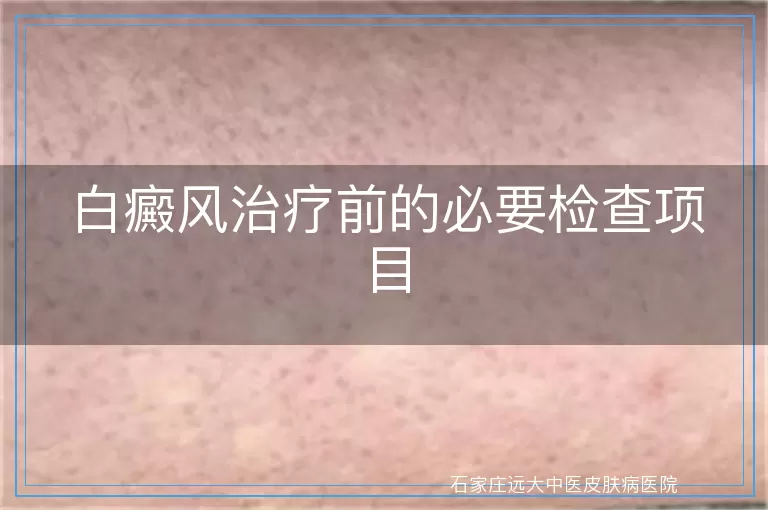 白癜风治疗前的必要检查项目