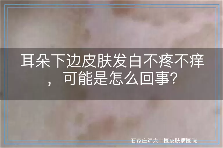 耳朵下边皮肤发白不疼不痒，可能是怎么回事？