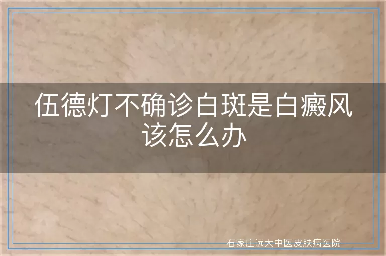 伍德灯不确诊白斑是白癜风该怎么办