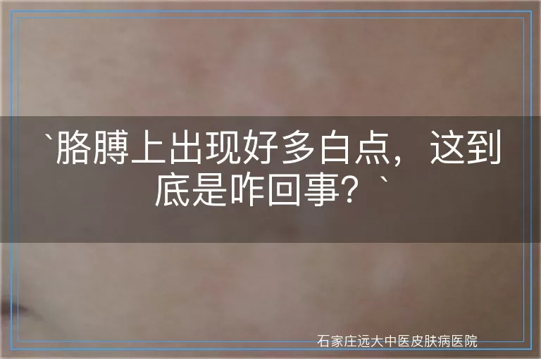 胳膊上出现好多白点，这到底是咋回事？