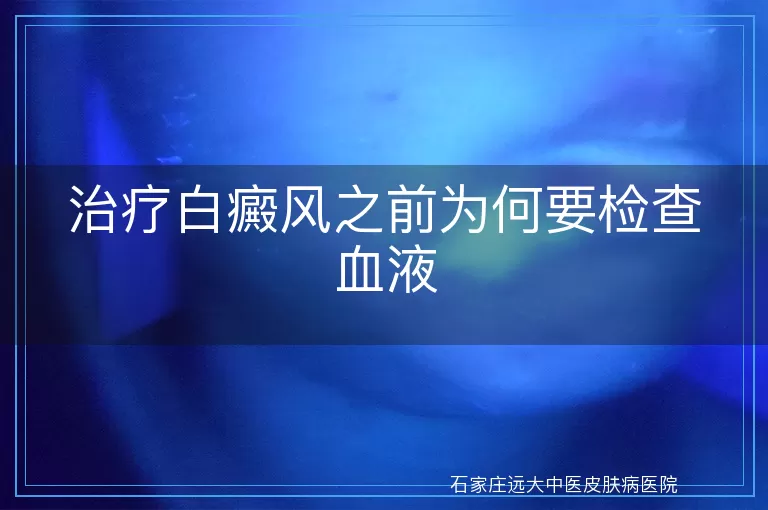 治疗白癜风之前为何要检查血液
