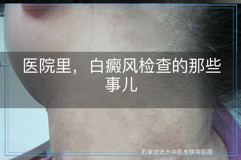 医院里，白癜风检查的那些事儿