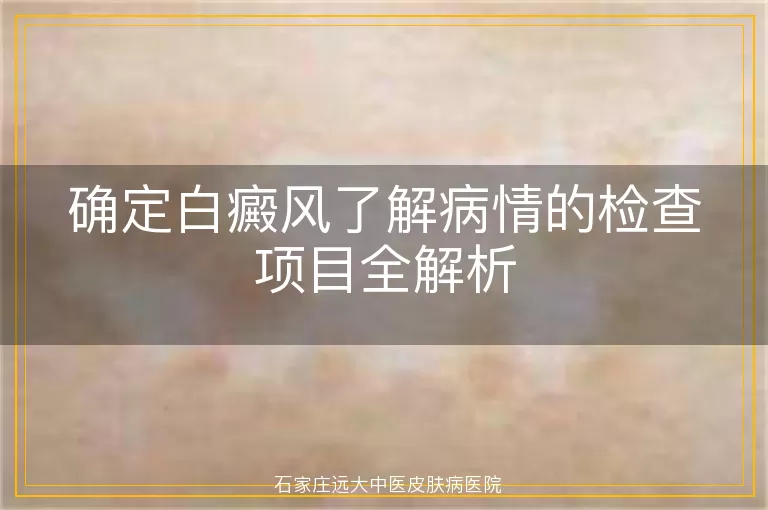 确定白癜风了解病情的检查项目全解析