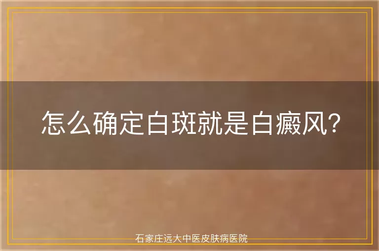 怎么确定白斑就是白癜风？