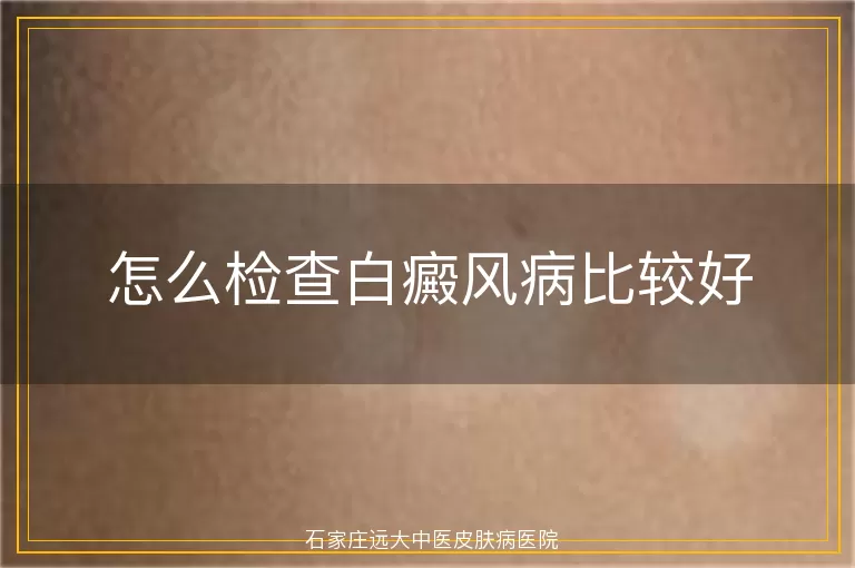 怎么检查白癜风病比较好