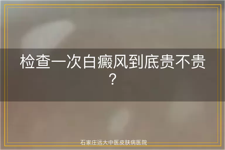 检查一次白癜风到底贵不贵？