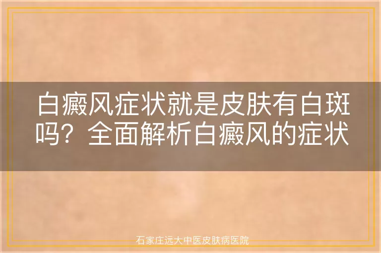 白癜风症状就是皮肤有白斑吗？全面解析白癜风的症状表现