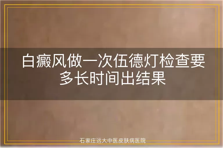 白癜风做一次伍德灯检查要多长时间出结果
